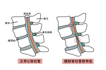 脊柱管の構造
